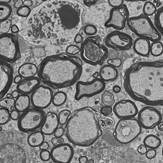electron microscopy